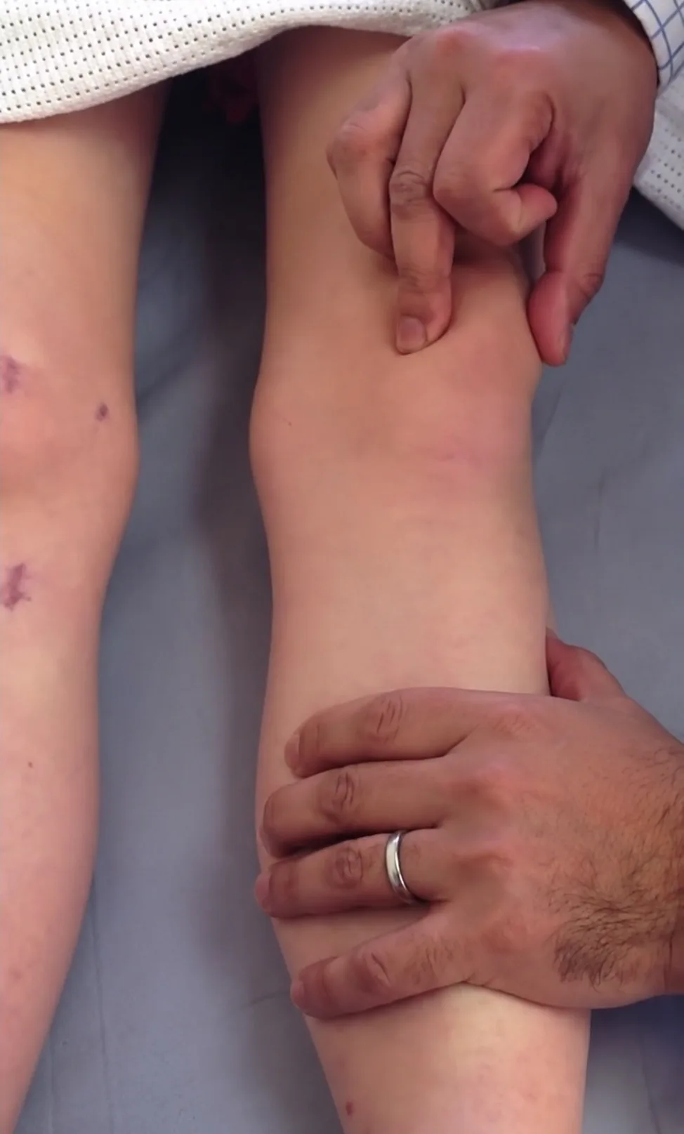 Mr Trikha examining a patient&rsquo;s patella